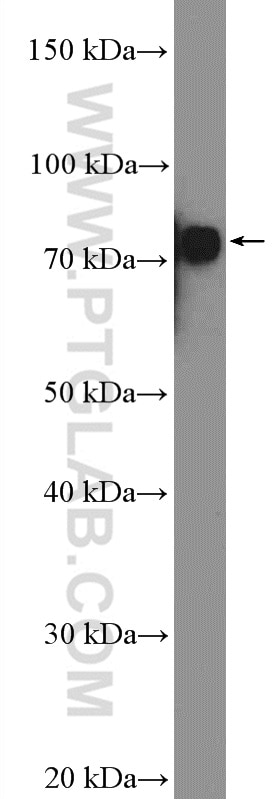 Western Blot (WB) analysis of rat brain tissue using p75NTR Polyclonal antibody (55014-1-AP)