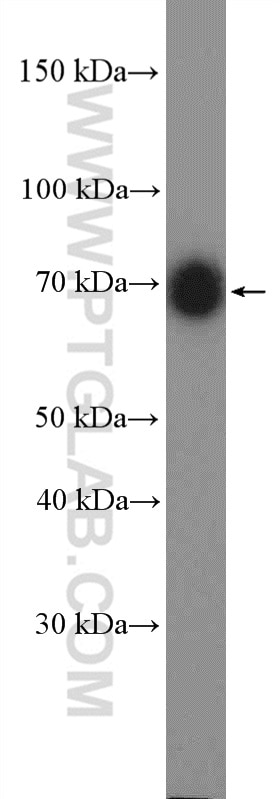 Western Blot (WB) analysis of mouse brain tissue using p75NTR Polyclonal antibody (55014-1-AP)