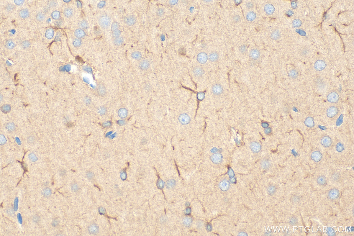 Immunohistochemistry (IHC) staining of rat brain tissue using NGFR/TNFRSF16 Polyclonal antibody (32505-1-AP)
