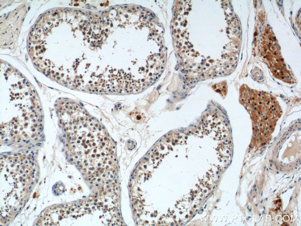 Immunohistochemistry (IHC) staining of human testis tissue using NGRN Polyclonal antibody (14885-1-AP)