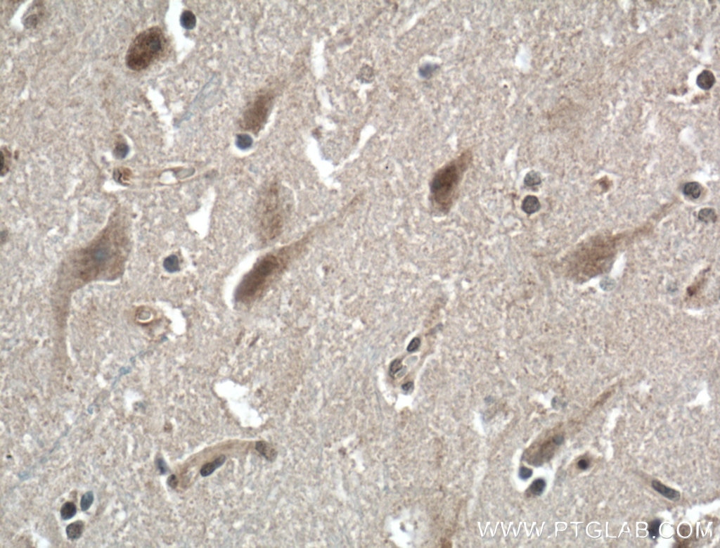 Immunohistochemistry (IHC) staining of human brain tissue using NGRN Polyclonal antibody (14885-1-AP)