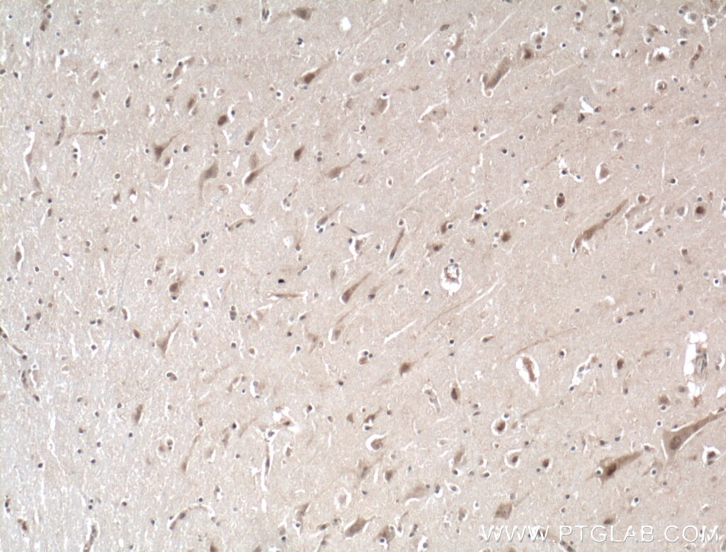 Immunohistochemistry (IHC) staining of human brain tissue using NGRN Polyclonal antibody (14885-1-AP)