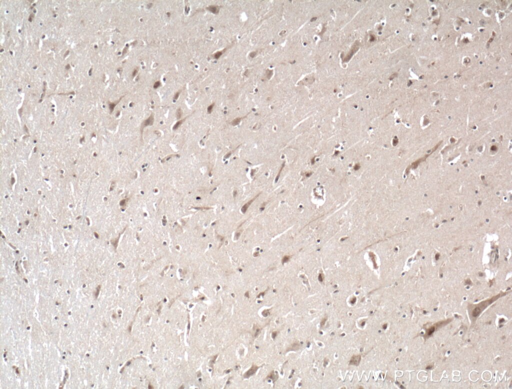 Immunohistochemistry (IHC) staining of human brain tissue using NGRN Polyclonal antibody (14885-1-AP)