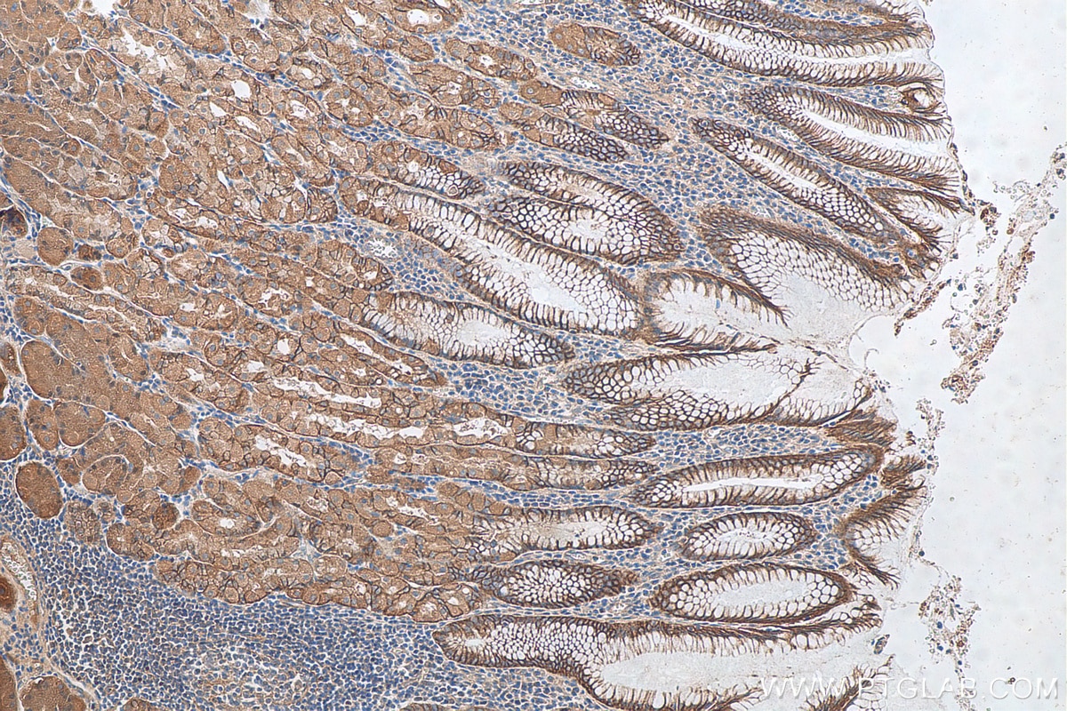 Immunohistochemistry (IHC) staining of human stomach tissue using NHE1 Polyclonal antibody (29761-1-AP)