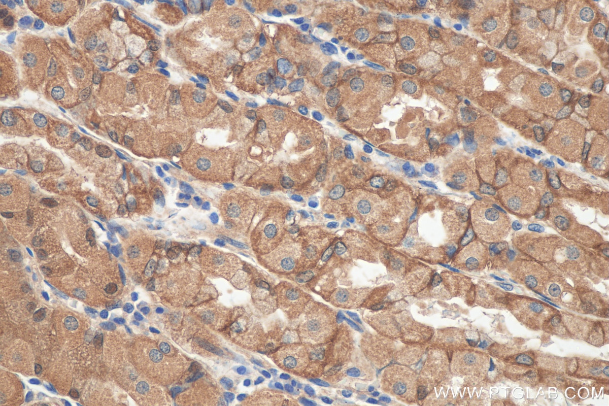 Immunohistochemistry (IHC) staining of human stomach tissue using NHE1 Polyclonal antibody (29761-1-AP)
