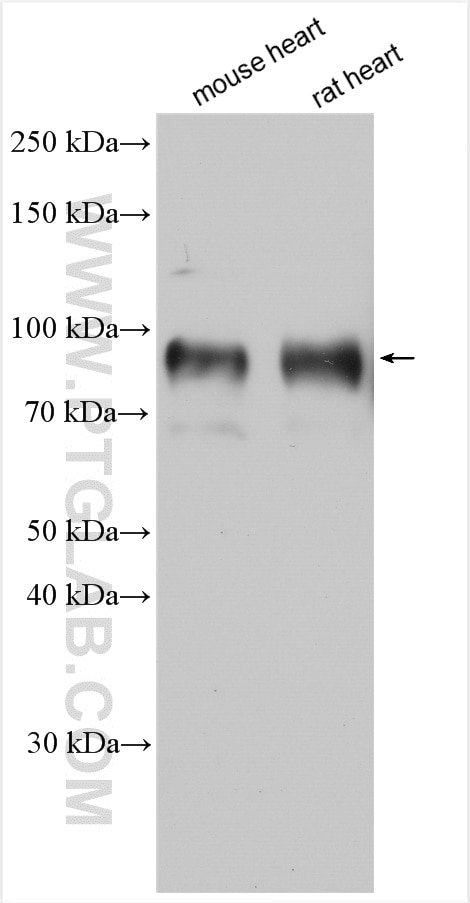 Western Blot (WB) analysis of various lysates using NHE1 Polyclonal antibody (29761-1-AP)