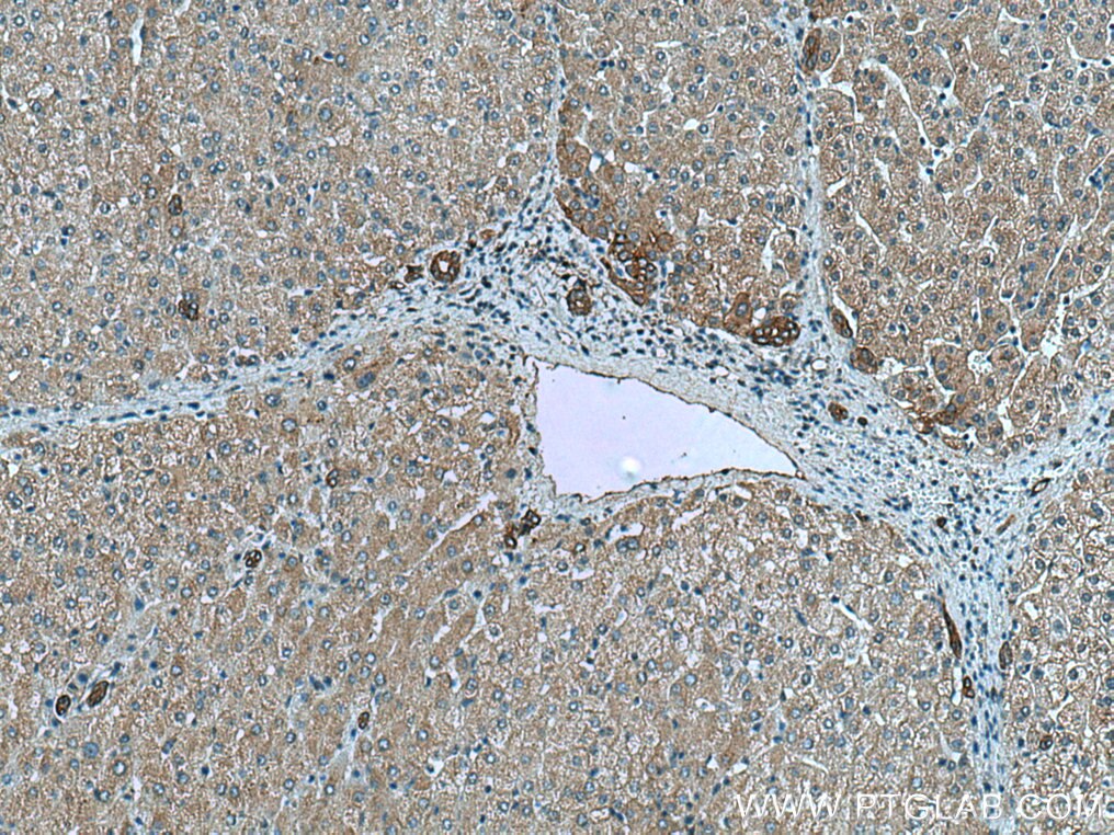 Immunohistochemistry (IHC) staining of human liver tissue using NHE1 Monoclonal antibody (67363-1-Ig)