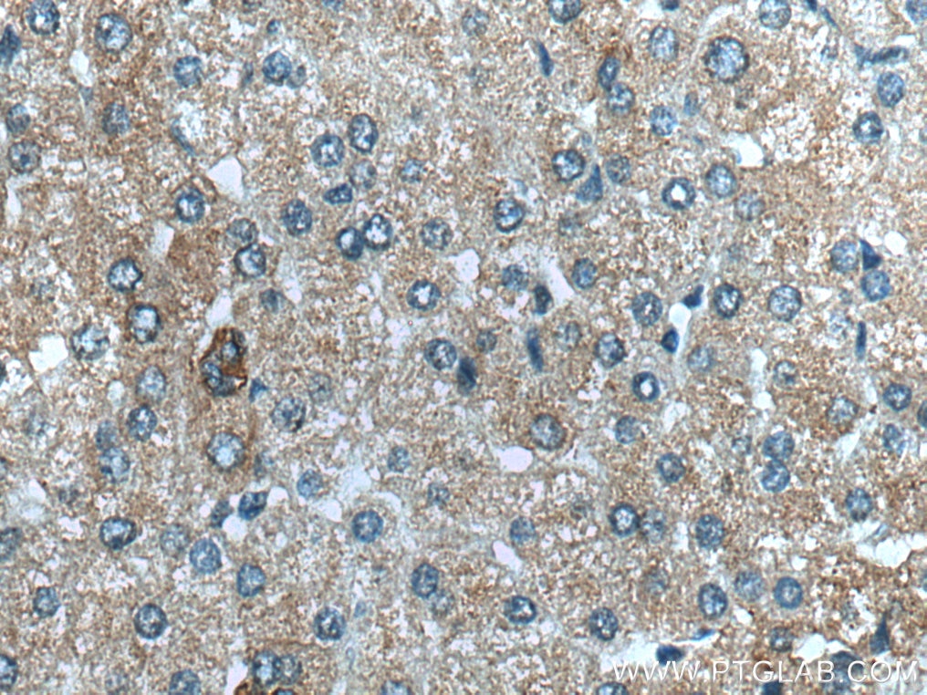 Immunohistochemistry (IHC) staining of human liver tissue using NHE1 Monoclonal antibody (67363-1-Ig)