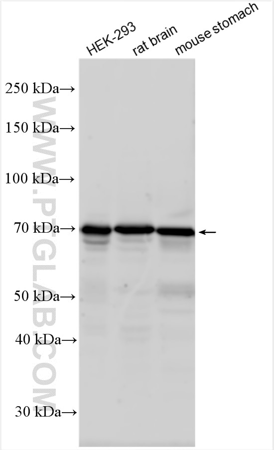 Western Blot (WB) analysis of various lysates using NHE2 Polyclonal antibody (25105-1-AP)