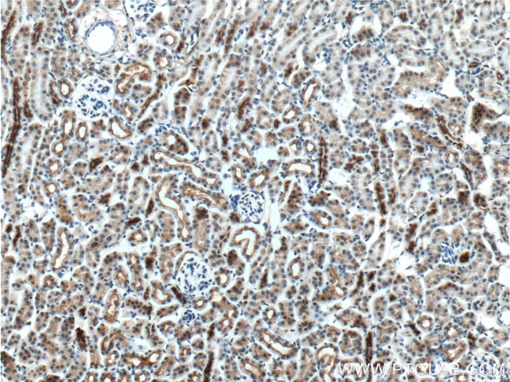 Immunohistochemistry (IHC) staining of mouse kidney tissue using NHE3 Polyclonal antibody (27190-1-AP)