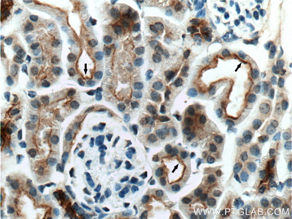 Immunohistochemistry (IHC) staining of mouse kidney tissue using NHE3 Polyclonal antibody (27190-1-AP)