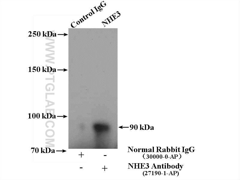 Immunoprecipitation (IP) experiment of mouse kidney tissue using NHE3 Polyclonal antibody (27190-1-AP)