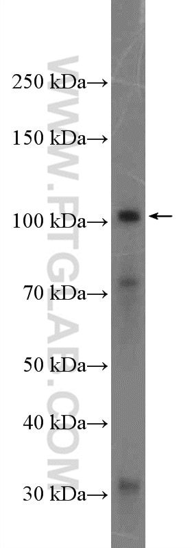 WB analysis of mouse small intestine using 27190-1-AP