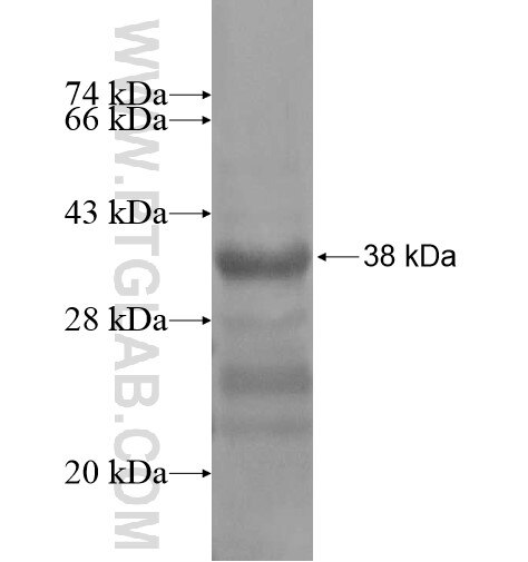 NHEDC1 fusion protein Ag14662 SDS-PAGE