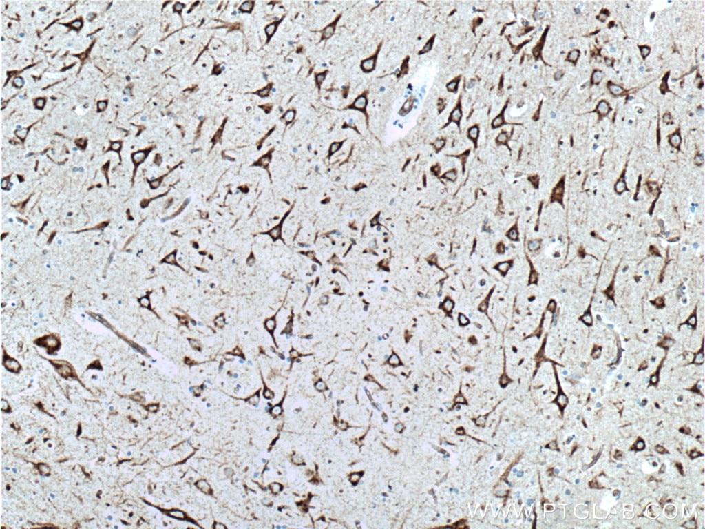 Immunohistochemistry (IHC) staining of human brain tissue using NHEDC2 Polyclonal antibody (24065-1-AP)