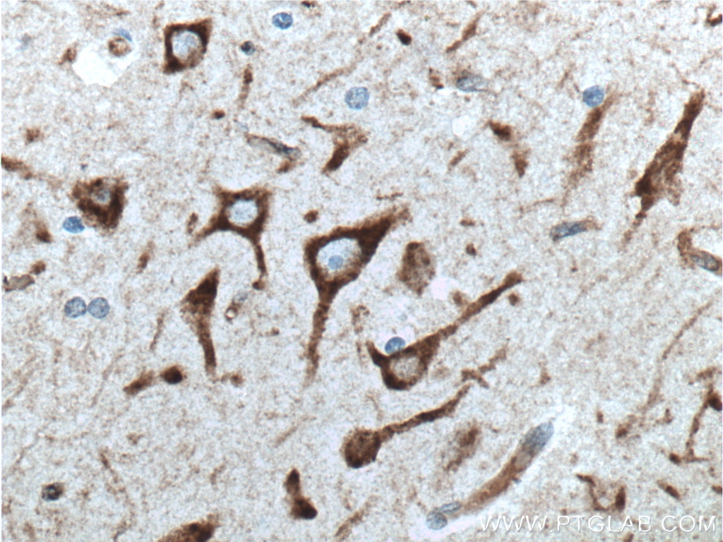 Immunohistochemistry (IHC) staining of human brain tissue using NHEDC2 Polyclonal antibody (24065-1-AP)