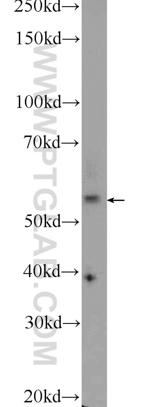 Western Blot (WB) analysis of human plasma using NHEDC2 Polyclonal antibody (24065-1-AP)