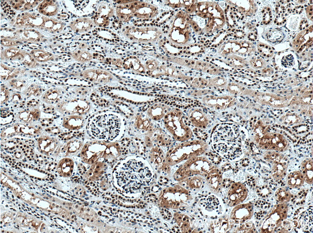 Immunohistochemistry (IHC) staining of human kidney tissue using XLF Monoclonal antibody (66552-1-Ig)