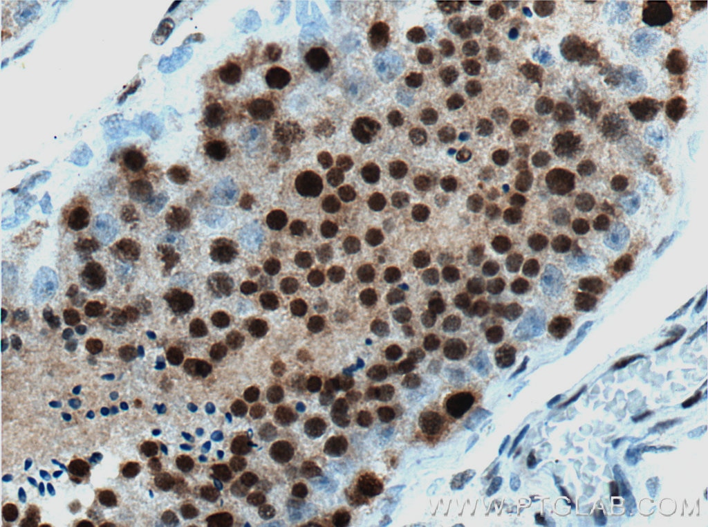 Immunohistochemistry (IHC) staining of human testis tissue using XLF Monoclonal antibody (66552-1-Ig)
