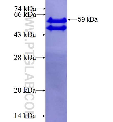 NHEJ1 fusion protein Ag2496 SDS-PAGE