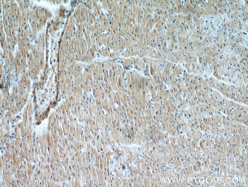 IHC staining of human heart using 21310-1-AP