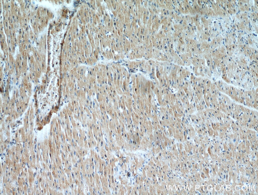 IHC staining of human heart using 21310-1-AP