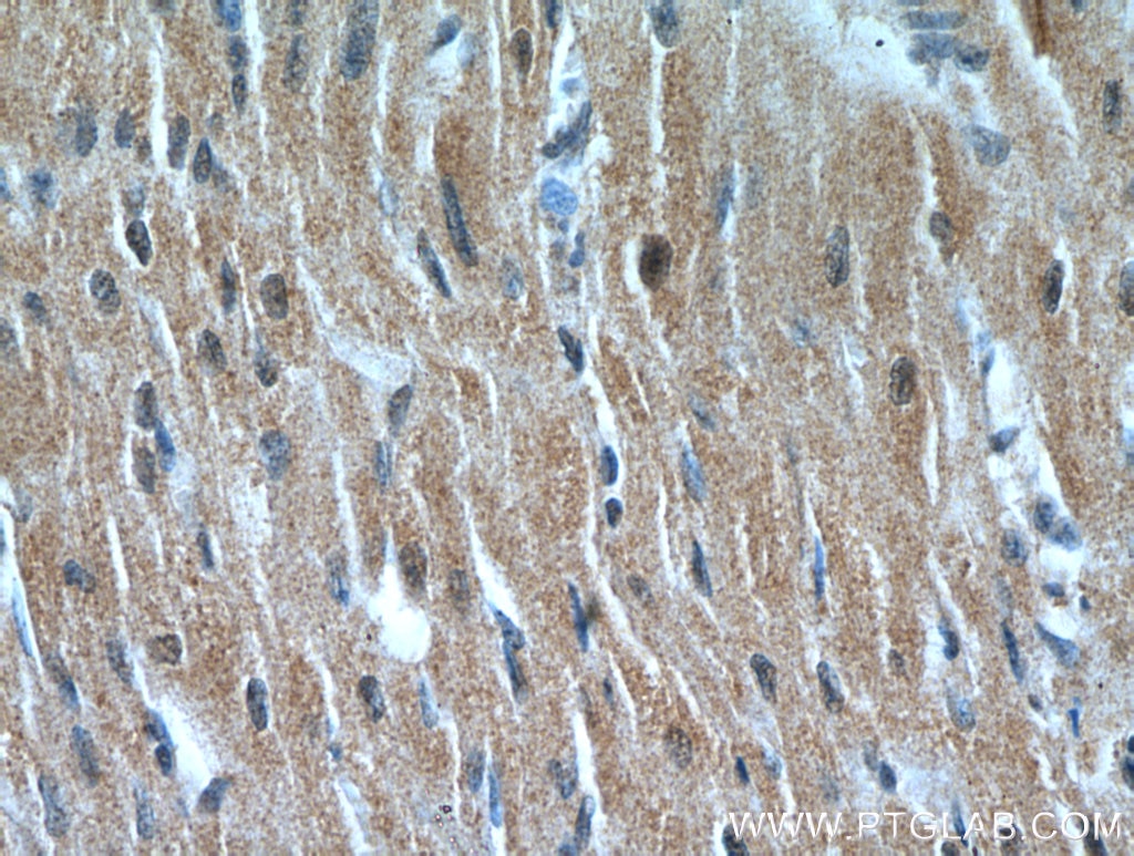 Immunohistochemistry (IHC) staining of human heart tissue using NHLRC1 Polyclonal antibody (21310-1-AP)