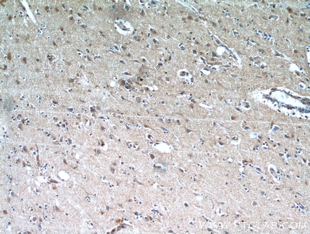 Immunohistochemistry (IHC) staining of human brain tissue using NHLRC1 Polyclonal antibody (21310-1-AP)