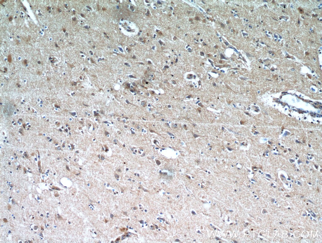 IHC staining of human brain using 21310-1-AP