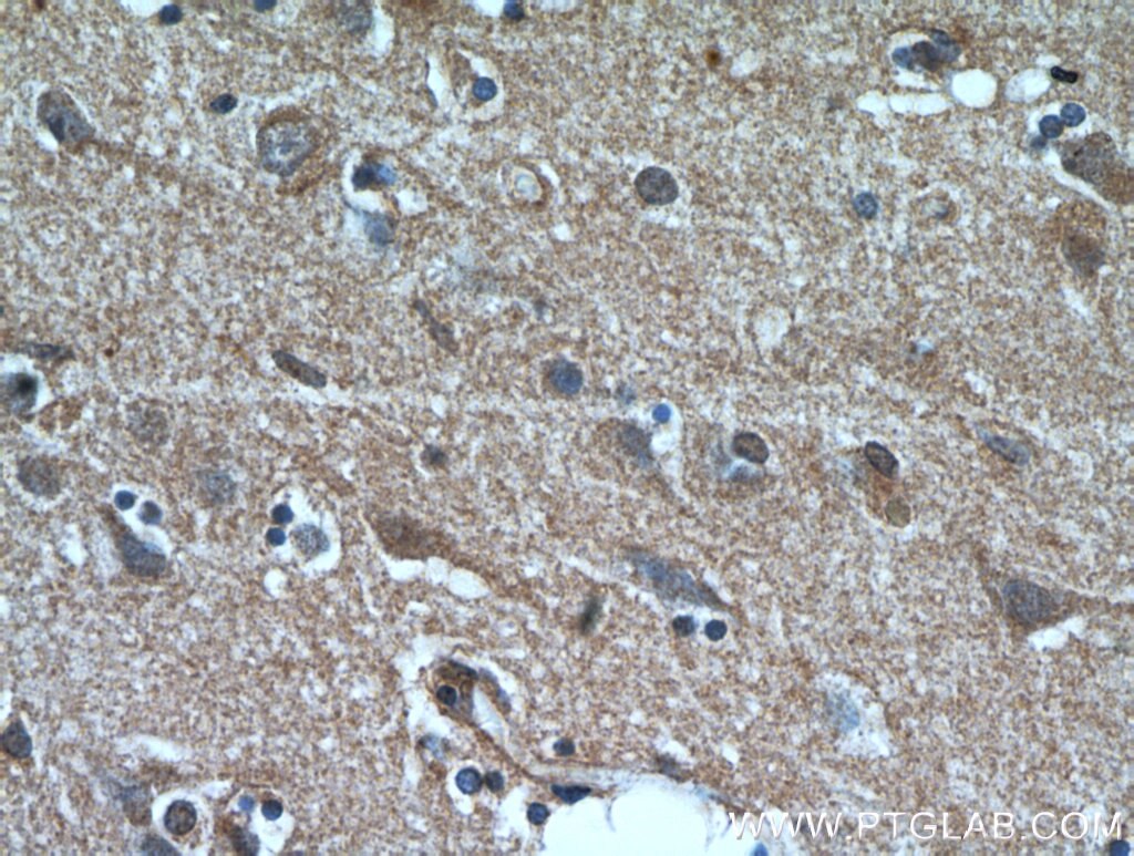 Immunohistochemistry (IHC) staining of human brain tissue using NHLRC1 Polyclonal antibody (21310-1-AP)