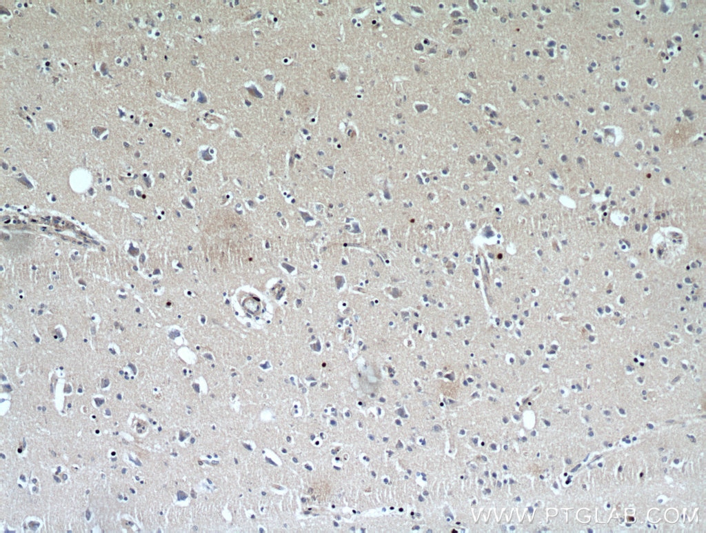 Immunohistochemistry (IHC) staining of human brain tissue using NHLRC1 Polyclonal antibody (21310-1-AP)