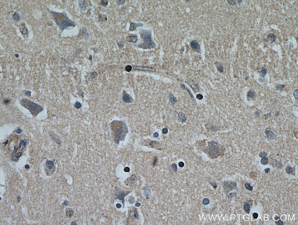 Immunohistochemistry (IHC) staining of human brain tissue using NHLRC1 Polyclonal antibody (21310-1-AP)