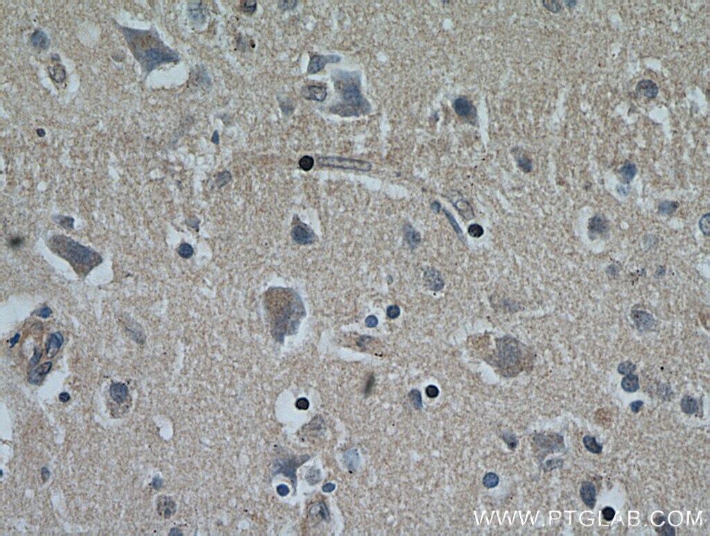 Immunohistochemistry (IHC) staining of human brain tissue using NHLRC1 Polyclonal antibody (21310-1-AP)