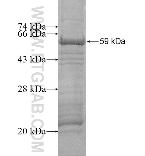 NHLRC1 fusion protein Ag15940 SDS-PAGE