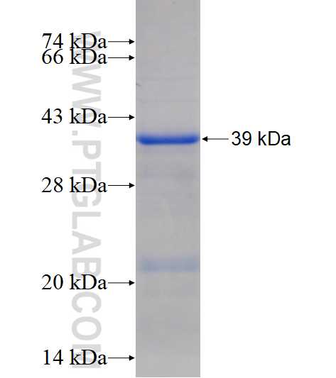 NHLRC1 fusion protein Ag17248 SDS-PAGE