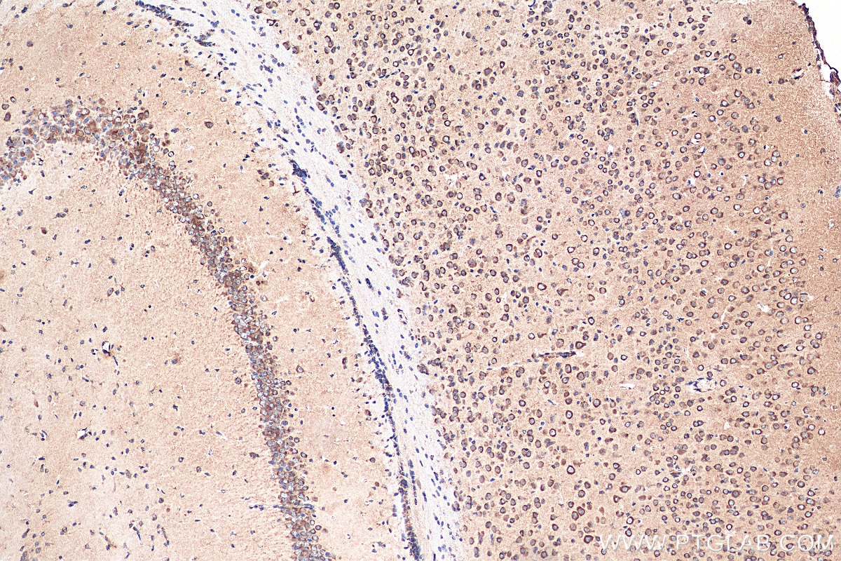 Immunohistochemistry (IHC) staining of mouse brain tissue using NHLRC2 Polyclonal antibody (29416-1-AP)