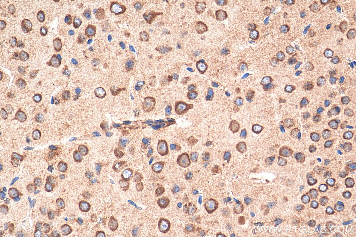 Immunohistochemistry (IHC) staining of mouse brain tissue using NHLRC2 Polyclonal antibody (29416-1-AP)