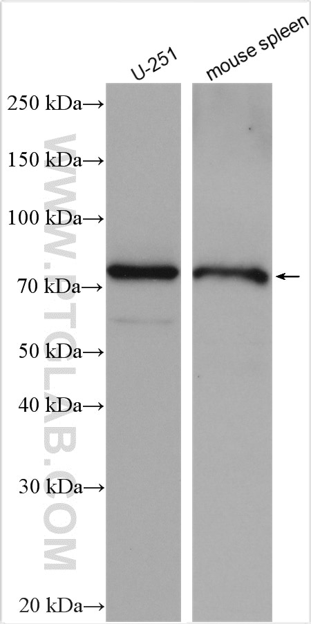 Western Blot (WB) analysis of various lysates using NHLRC2 Polyclonal antibody (29416-1-AP)
