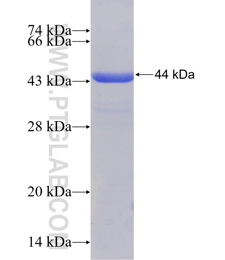 NHLRC2 fusion protein Ag30159 SDS-PAGE