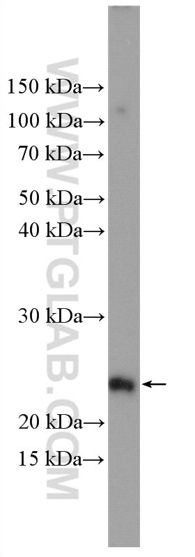 Western Blot (WB) analysis of Caco-2 cells using NHP2 Polyclonal antibody (15128-1-AP)