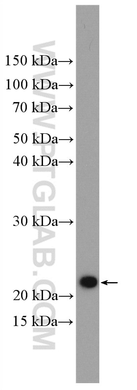 WB analysis of HeLa using 15128-1-AP