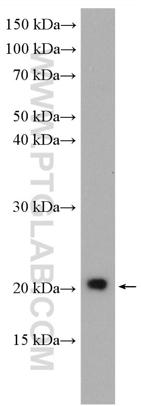 Western Blot (WB) analysis of SH-SY5Y cells using NHP2 Polyclonal antibody (15128-1-AP)