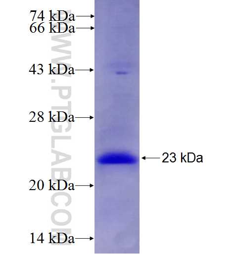 NHP2 fusion protein Ag7580 SDS-PAGE