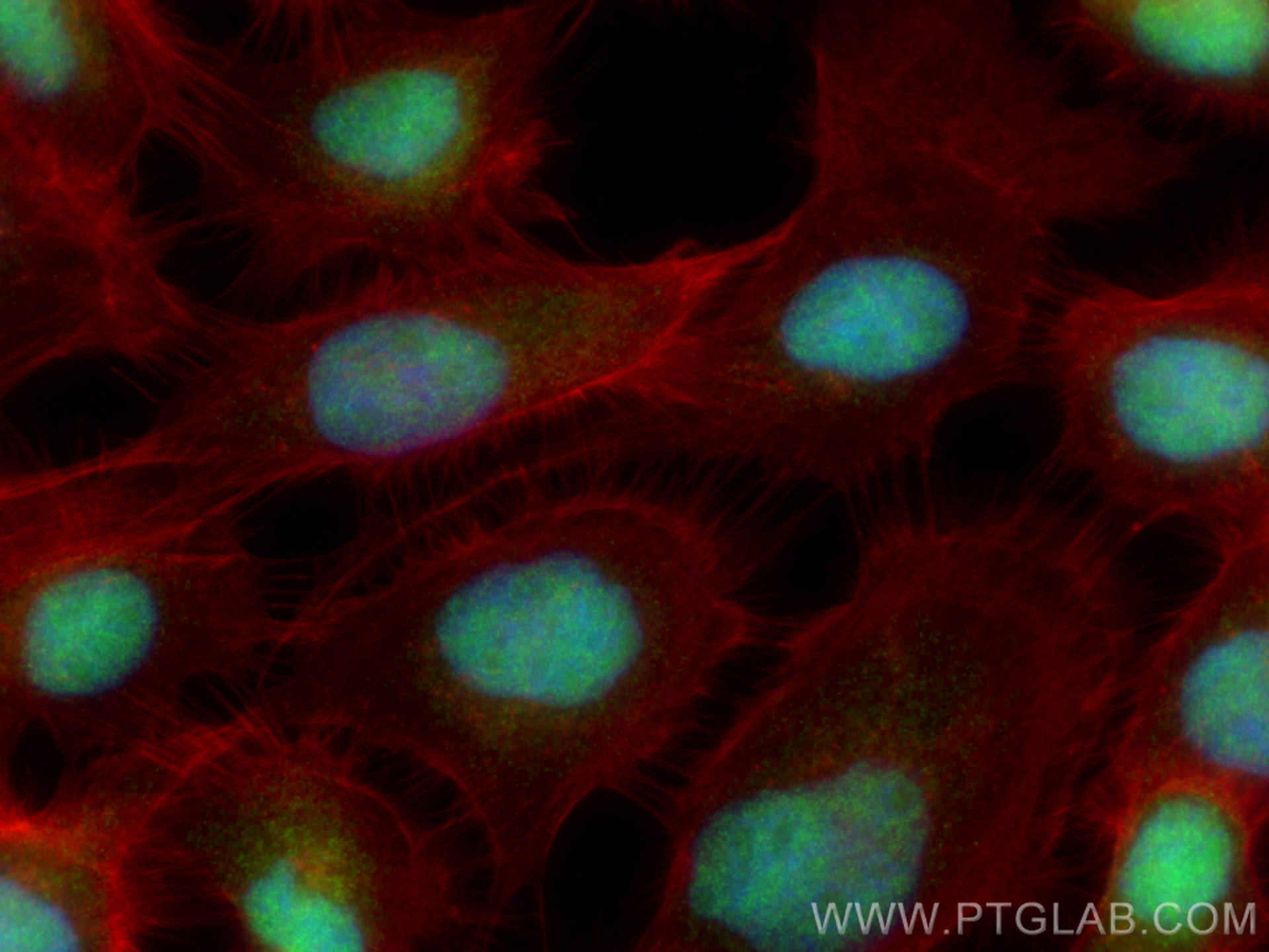 Immunofluorescence (IF) / fluorescent staining of A431 cells using NHP2L1 Polyclonal antibody (15802-1-AP)