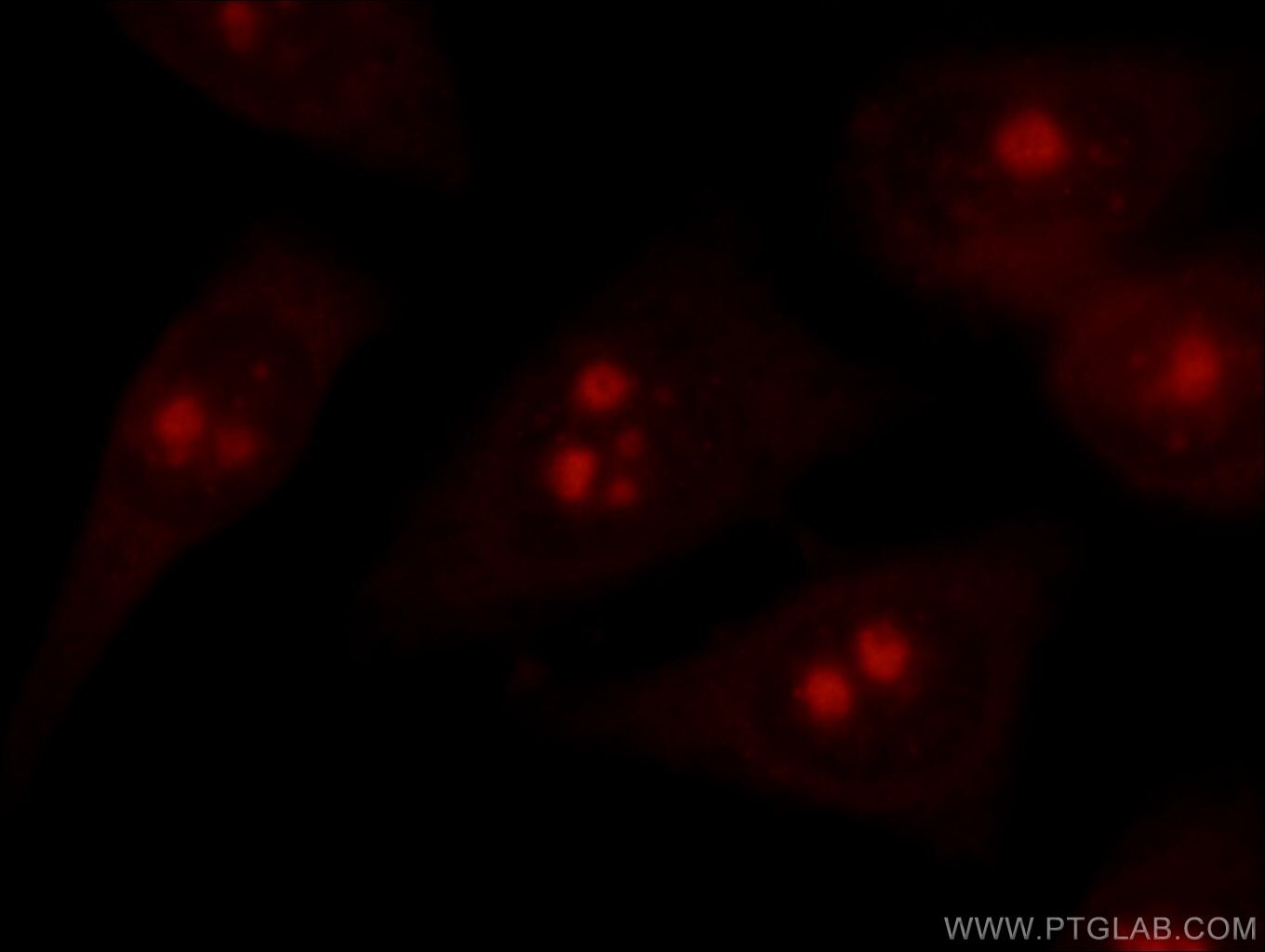 IF Staining of HeLa using 15802-1-AP