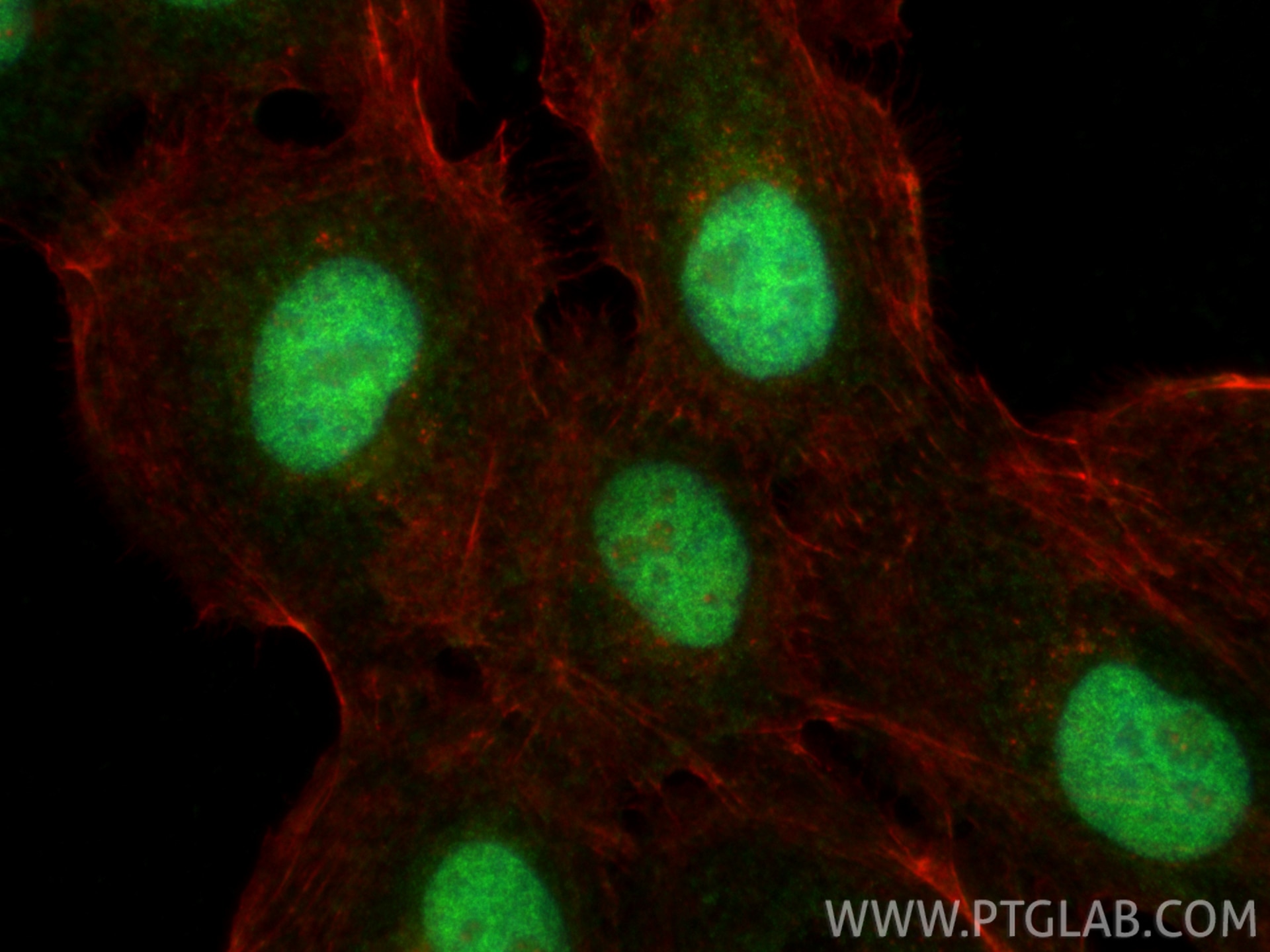 Immunofluorescence (IF) / fluorescent staining of A431 cells using NHP2L1 Polyclonal antibody (15802-1-AP)