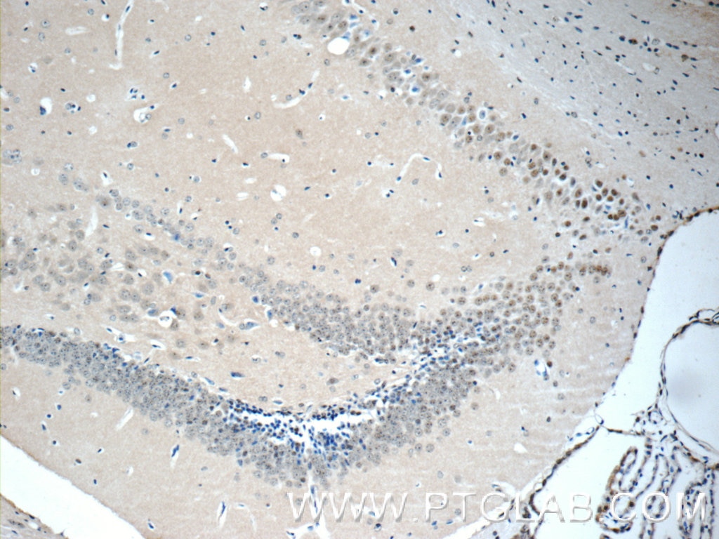 Immunohistochemistry (IHC) staining of mouse brain tissue using NHP2L1 Polyclonal antibody (15802-1-AP)
