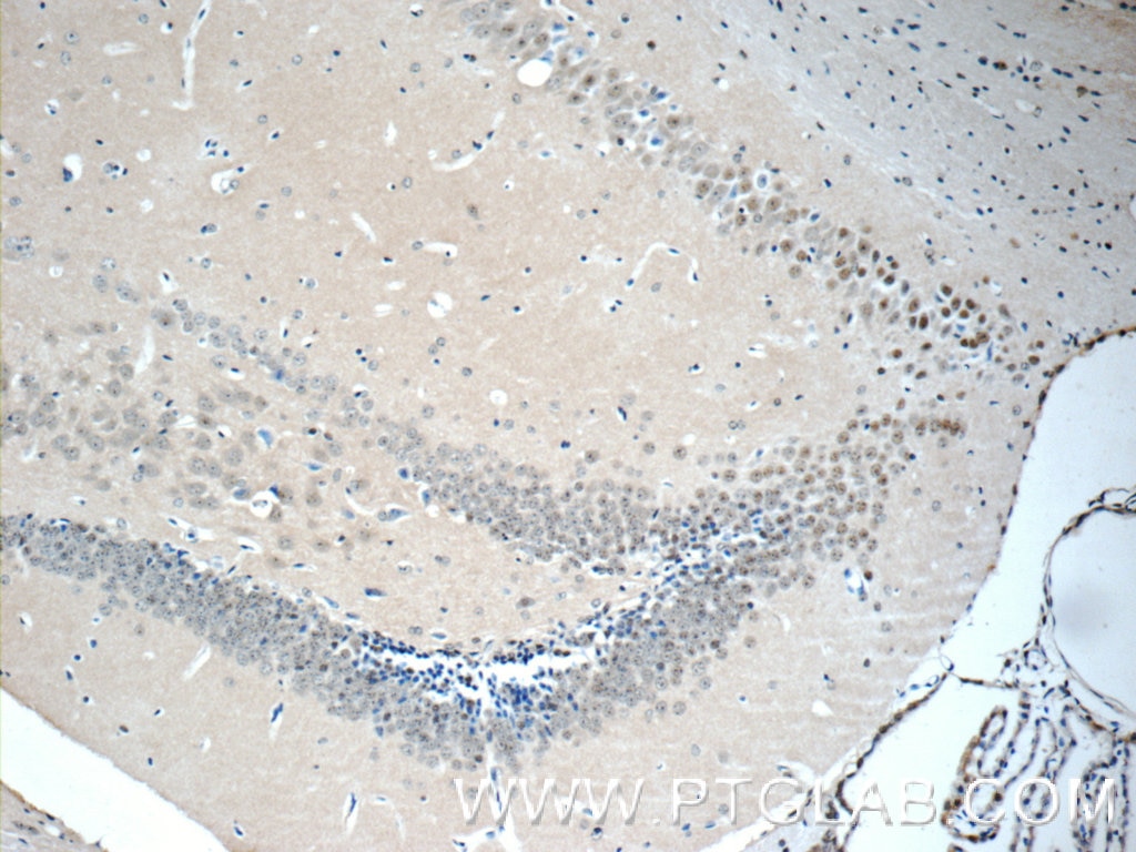 IHC staining of mouse brain using 15802-1-AP