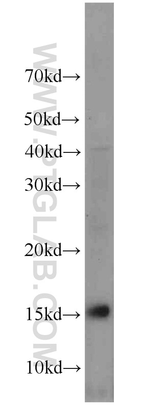 Western Blot (WB) analysis of human brain tissue using NHP2L1 Polyclonal antibody (15802-1-AP)