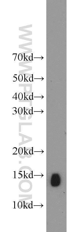 Western Blot (WB) analysis of MCF-7 cells using NHP2L1 Polyclonal antibody (15802-1-AP)